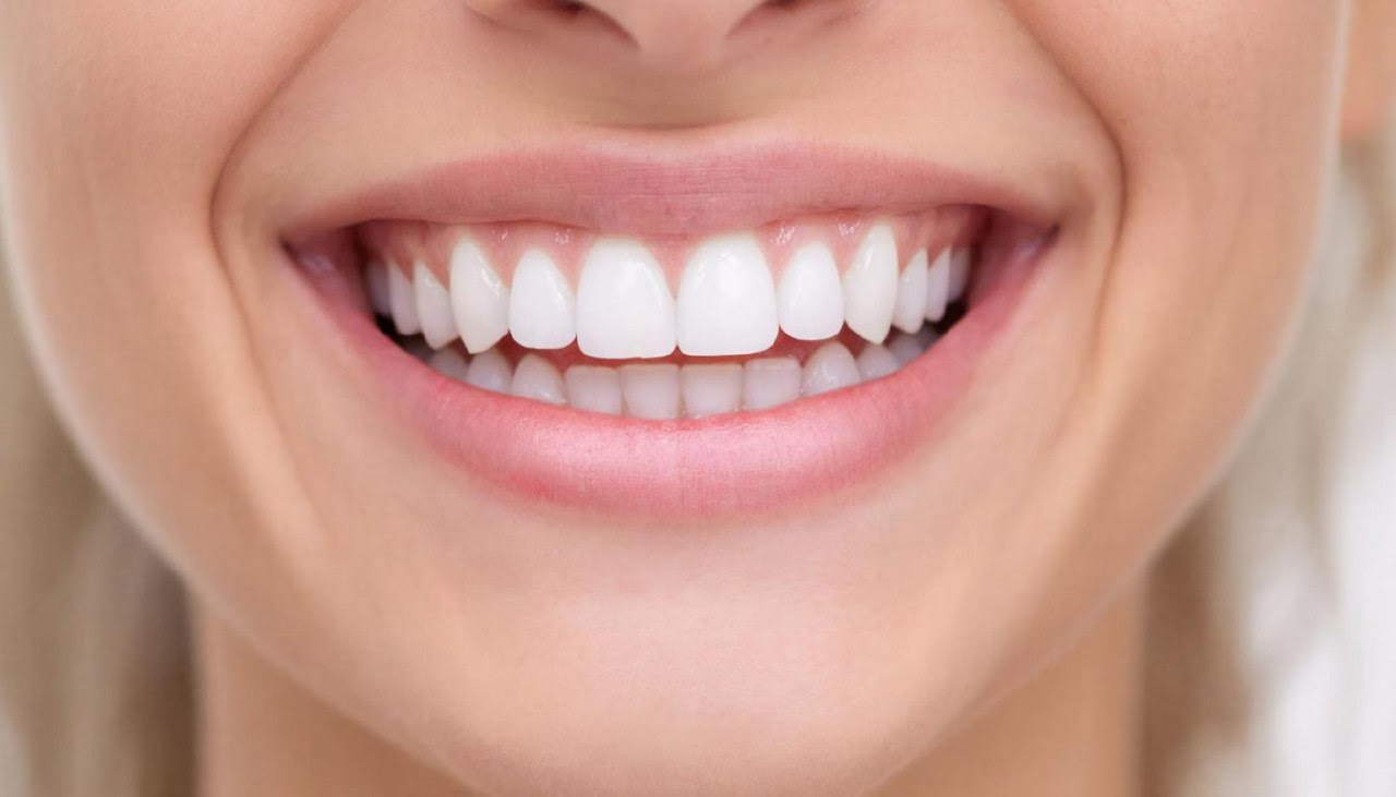 Кому нельзя отбеливать зубы? Стоматолог перечислил главные противопоказания