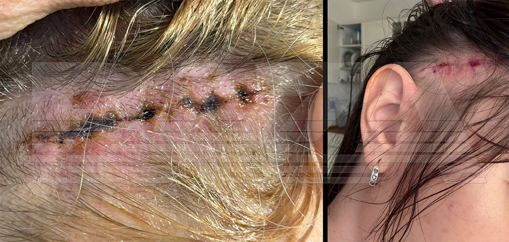 Как фальшивые фото в соцсетях толкают людей на опасные операции