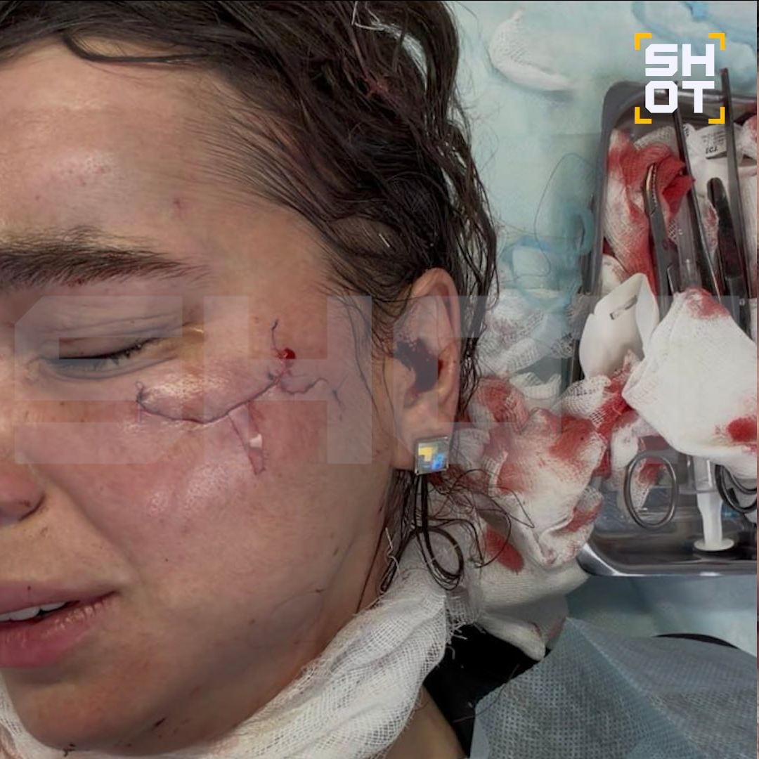 Напавшая кричала: — Мне ничего не будет!, пока жертва заливала пол кровью